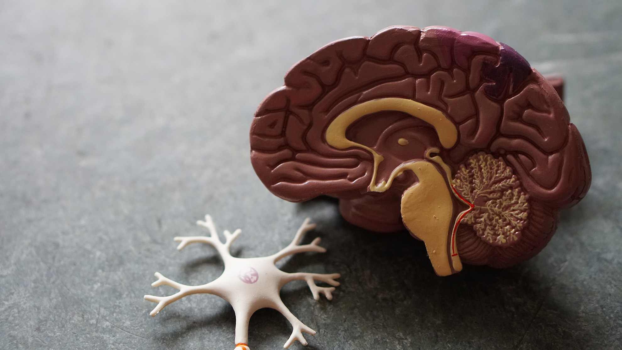 cognitive remediation